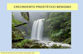Hiperplasia prostata