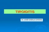 5. tiroiditis