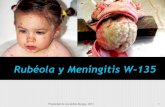 Rubeóla & Meningitis W-135