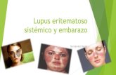 Lupus eritematoso sistémico y embarazo Ginecologia y obstetricia