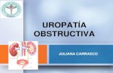 Uropatía obstructiva respaldo