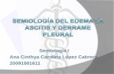 Semiología del edema y derrame pleural