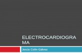 Electrocardiograma básico e IAM