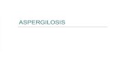Aspergilosis Dr Arellano