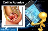Colitis actínica