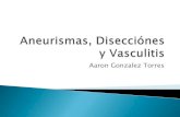 Aneurismas, disecciones y vasculitis