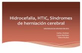 Hidrocefalia, HTIC, sindromes de herniacion