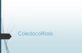 Coledocolitiasis y colangitis