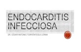 Endocarditis infecciosa 2013