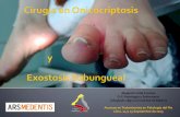 Cirugía en onicocriptosis y exostosis subungueal