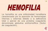 Presentacion para reformular- hemofilia