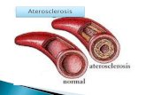 Aterosclerosis diapositivas