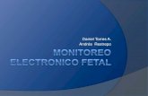 Monitoreo electronico fetal