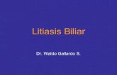 Litiasis Biliar Dr. Gallardo