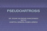 Pseudoartrosis (2)