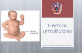 Hernias umbilicales y post