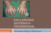 Esclerosis sistémica progresiv afin