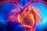 Cardiopatías congénitas FULL