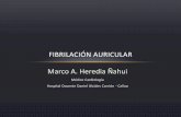 Fibrilación auricular