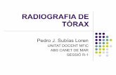 Radiografia de tòrax
