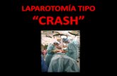 Laparotomía tipo crash
