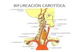 Bifurcación carotídea y carótida externa