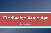 Fibrilacion Auricular - Dr. Bosio