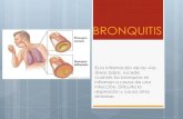 Bronquitis aguda