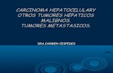 Carcinoma  otros tumo