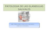 Patologia Benigna de las Glandula Salivales