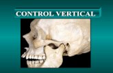 Control vertical en ortodoncia