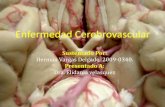Enfermedad cerebrovascular herman diapositiva