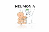 Neumonía en Pediatria