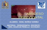 Abseso periodontal
