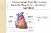 Cardiopatías más comunes resultantes de la tabicación cardiaca