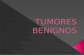 Tumores benignos (1)...