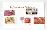 Anemias de enfermedades cronicas