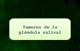 Tumores de la glandula salival uac