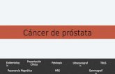 Cáncer de próstata radiologia