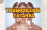 Tuberculosis cutánea.