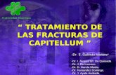 Fractura de Capitellum