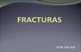 Fracturas (óscar)
