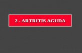 Artritis aguda