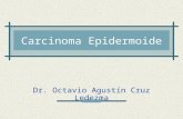 Carcinoma epidermoide
