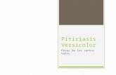 Pitiriasis versicolor