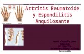 Artritis Reumatoidea Y Espondilitis Anquilosante
