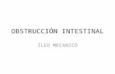 ÍLEO MECANICO, Obstruccion Intestinal