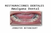 Restauraciones dentales en amalgama