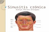 Sinusitis crónica