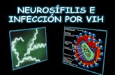 Neurosífilis e infección x vih